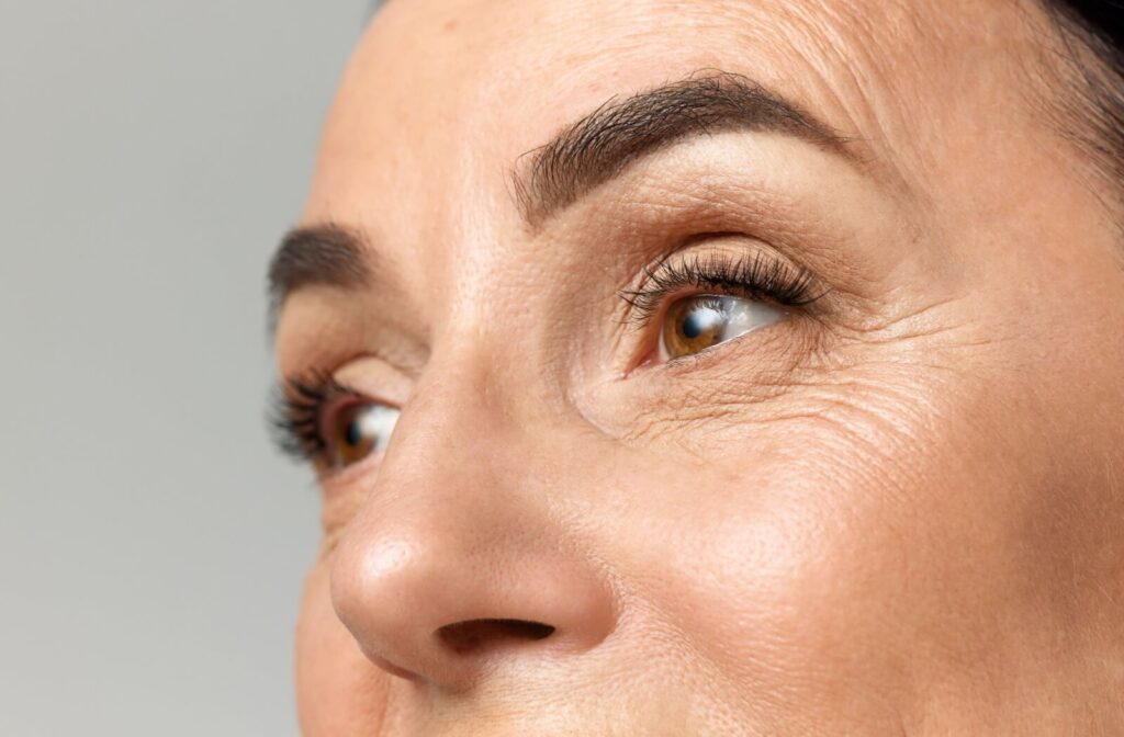 Close-up view of facial skin around the eyes highlighting fine lines and natural texture.