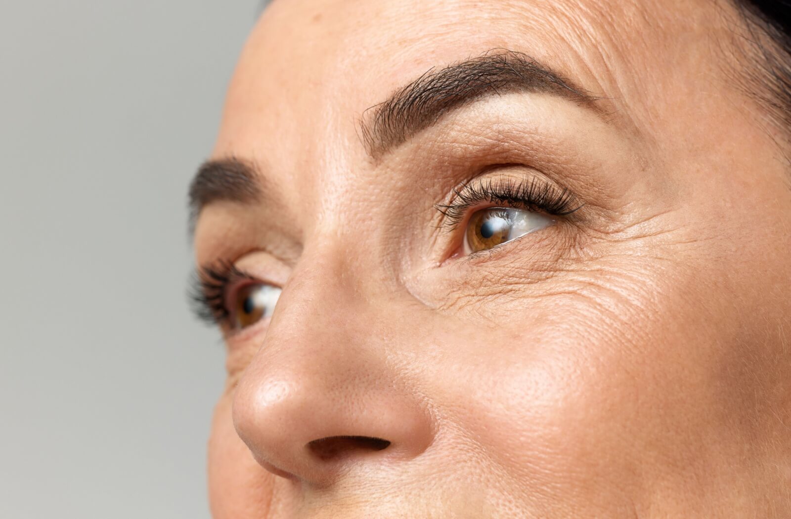Close-up view of facial skin around the eyes highlighting fine lines and natural texture.